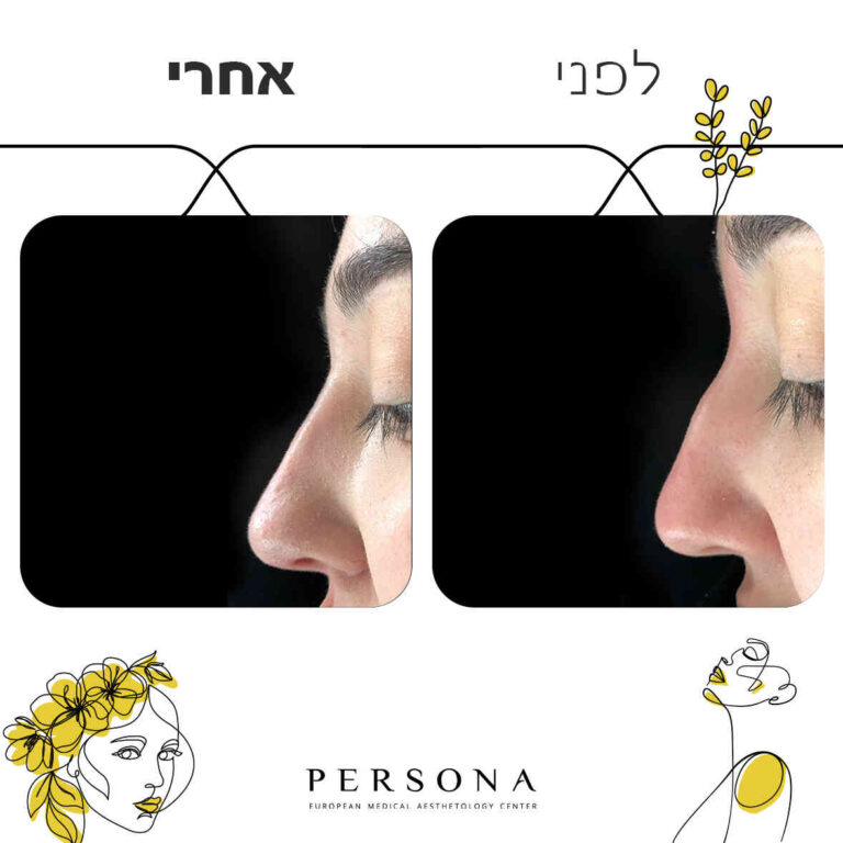 fb-17-2-copy_optimized