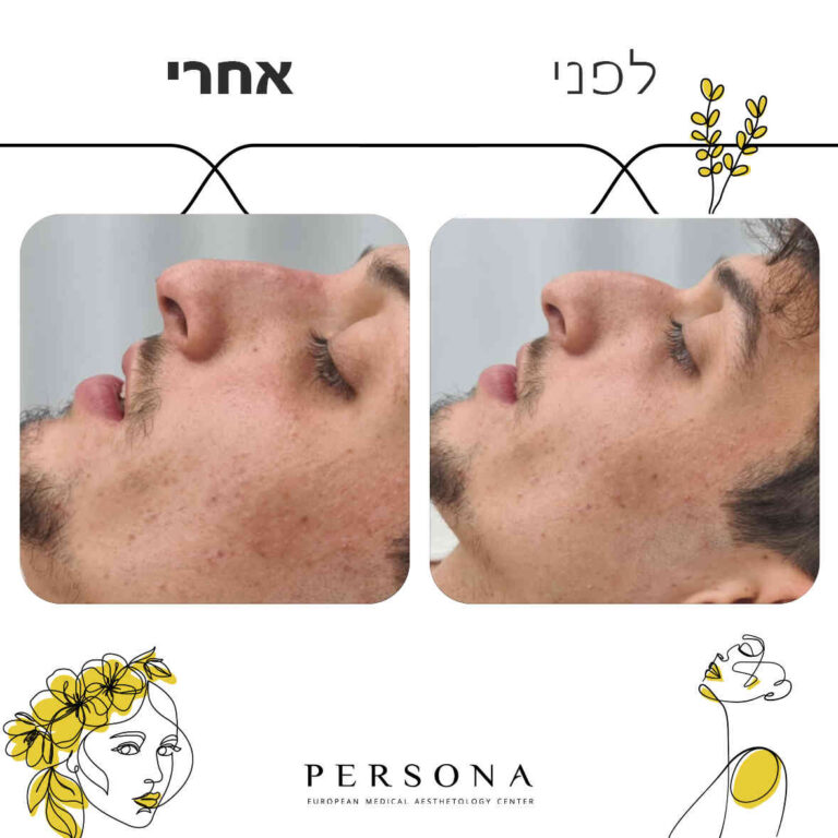 תבנית-לפני-אחרי6-copy_optimized